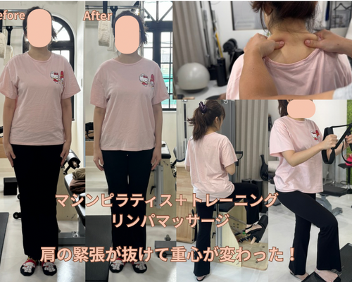 Before - 28